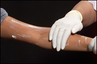 Consultant applying cream to patient